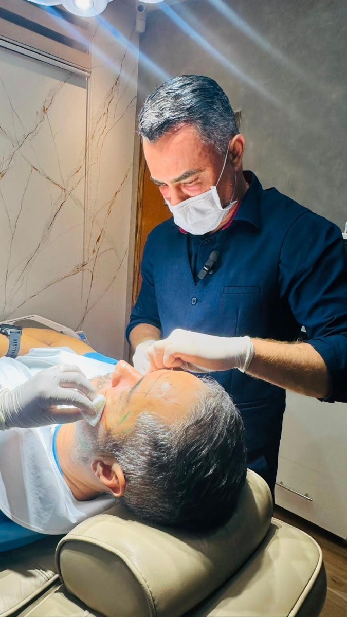 Procedimento de harmonização facial na CAMOA